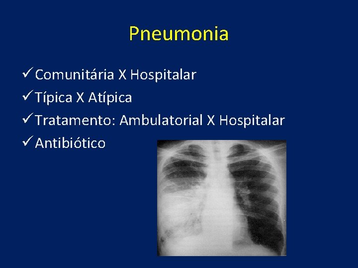 Pneumonia ü Comunitária X Hospitalar ü Típica X Atípica ü Tratamento: Ambulatorial X Hospitalar