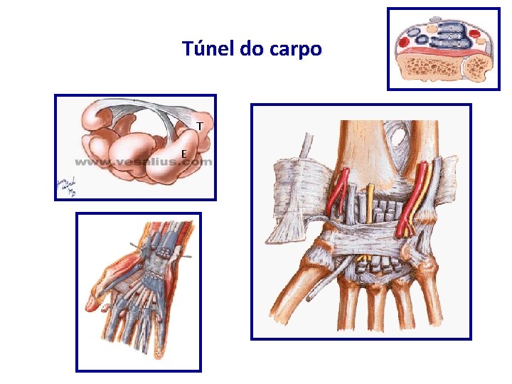 Túnel do carpo T E 