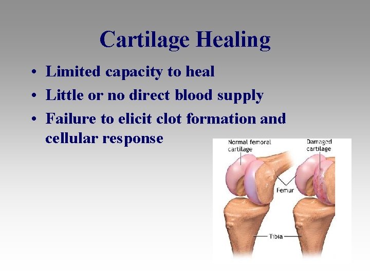 Cartilage Healing • Limited capacity to heal • Little or no direct blood supply