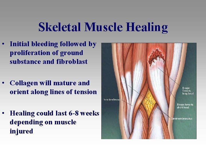 Skeletal Muscle Healing • Initial bleeding followed by proliferation of ground substance and fibroblast