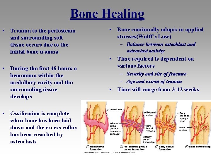 Bone Healing • Trauma to the periosteum and surrounding soft tissue occurs due to