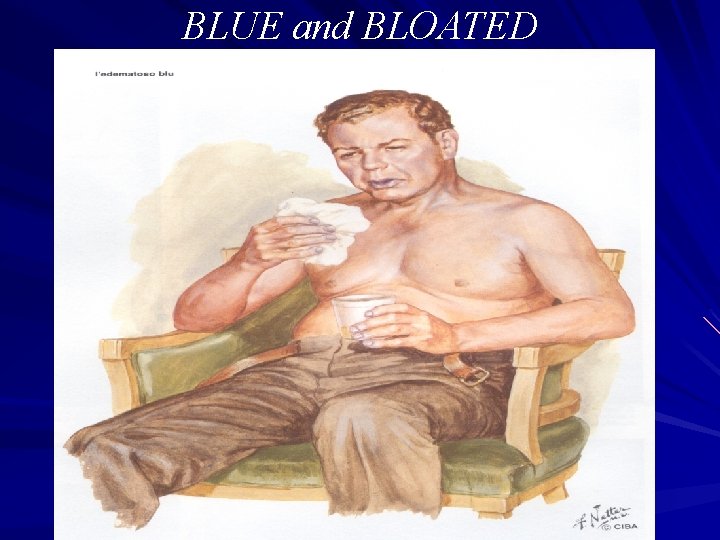 BLUE and BLOATED 