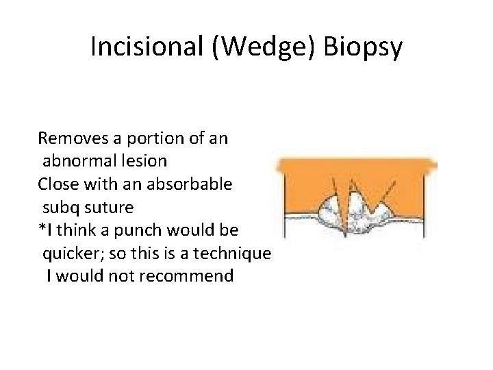 Incisional (Wedge) Biopsy Removes a portion of an abnormal lesion Close with an absorbable