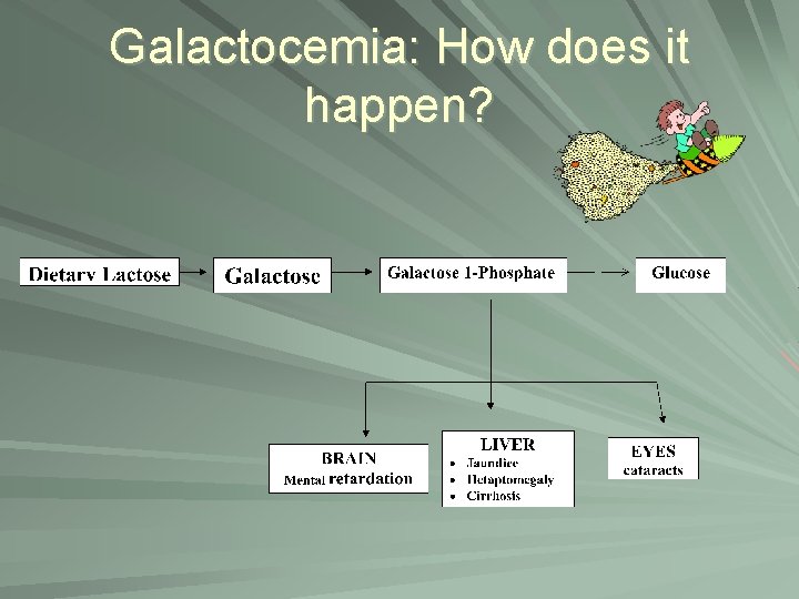 Galactocemia: How does it happen? 