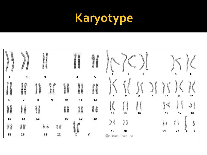 Karyotype Normal Female Normal Male 