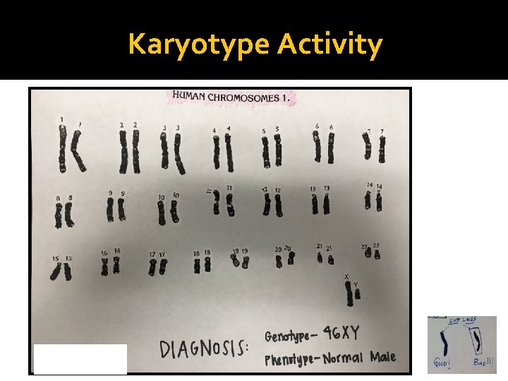 Karyotype Activity 