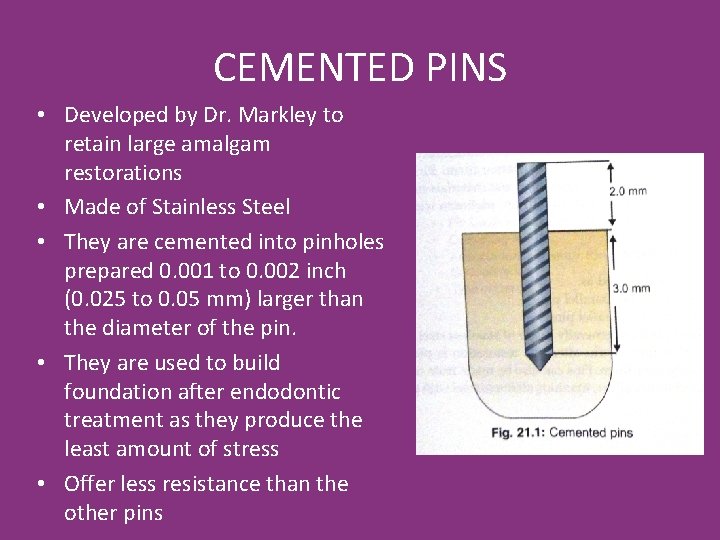 CEMENTED PINS • Developed by Dr. Markley to retain large amalgam restorations • Made