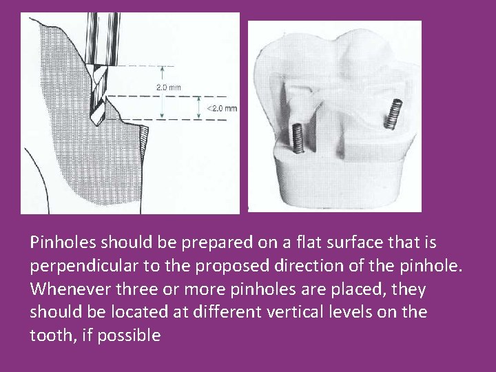 Pinholes should be prepared on a flat surface that is perpendicular to the proposed