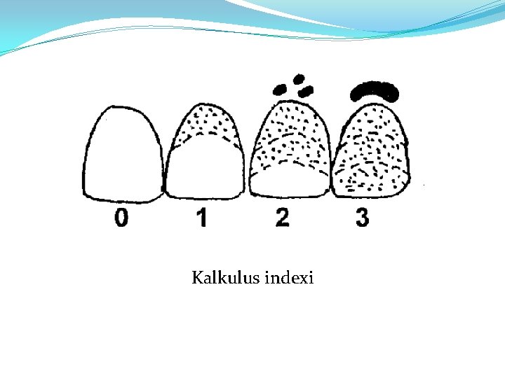 Kalkulus indexi 