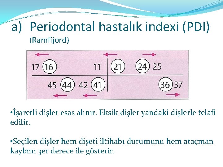 a) Periodontal hastalık indexi (PDI) (Ramfijord) • İşaretli dişler esas alınır. Eksik dişler yandaki