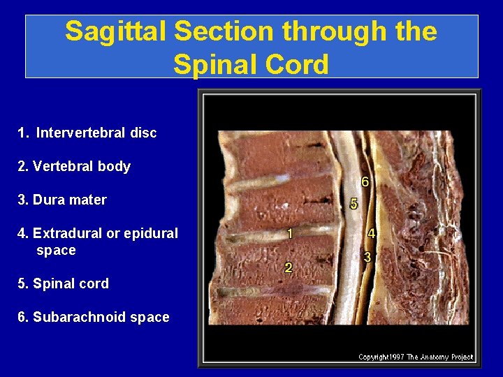 Sagittal Section through the Spinal Cord 1. Intervertebral disc 2. Vertebral body 3. Dura