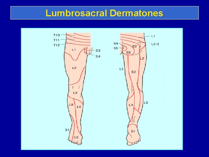 Lumbrosacral Dermatones 