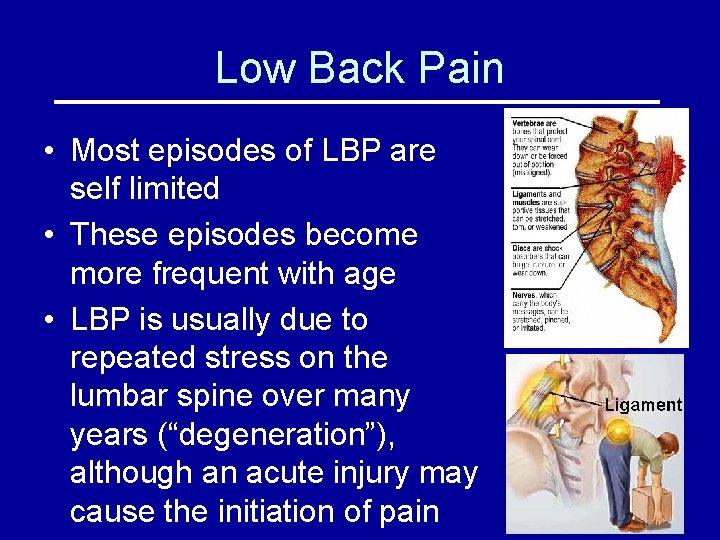 Low Back Pain • Most episodes of LBP are self limited • These episodes