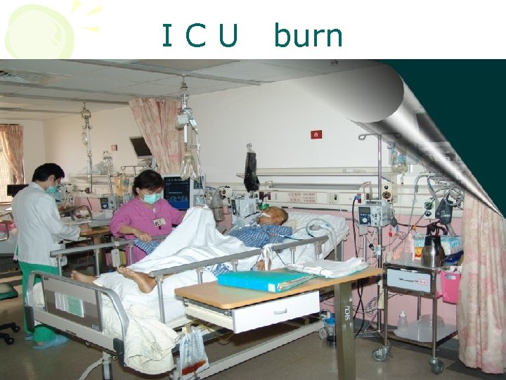 ICU burn 