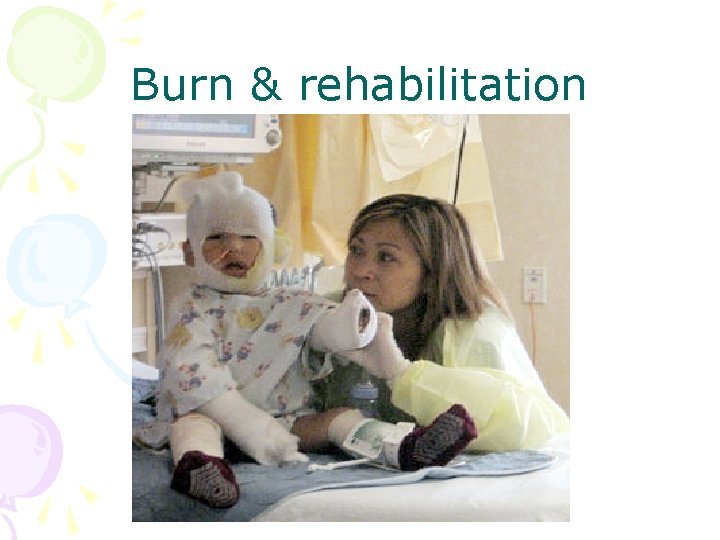 Burn & rehabilitation 