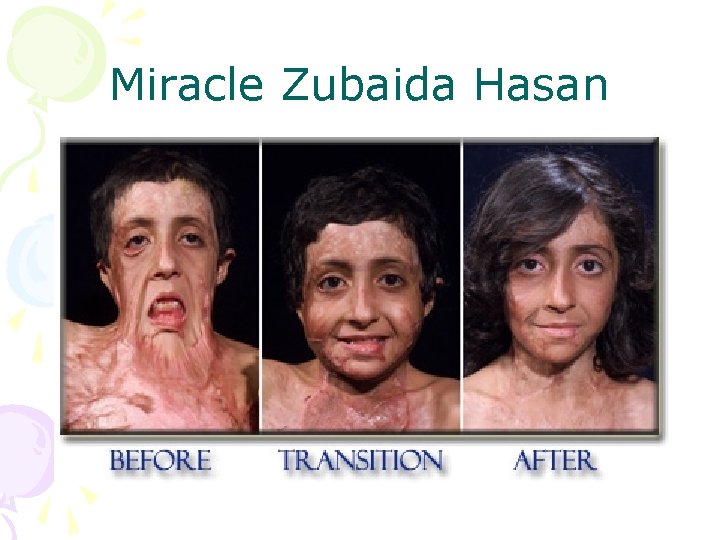 Miracle Zubaida Hasan 
