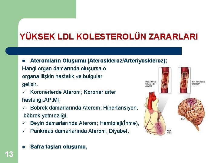YÜKSEK LDL KOLESTEROLÜN ZARARLARI Ateromların Oluşumu (Ateroskleroz/Arteriyoskleroz); Hangi organ damarında oluşursa o organa ilişkin
