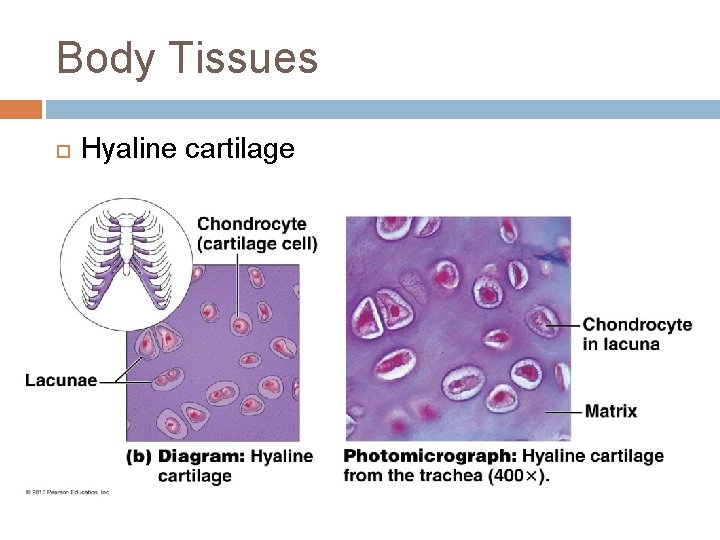 Body Tissues Hyaline cartilage 