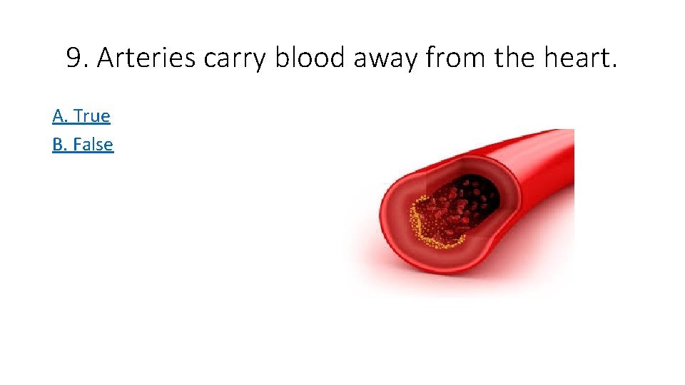 9. Arteries carry blood away from the heart. A. True B. False 