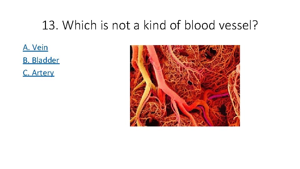 13. Which is not a kind of blood vessel? A. Vein B. Bladder C.