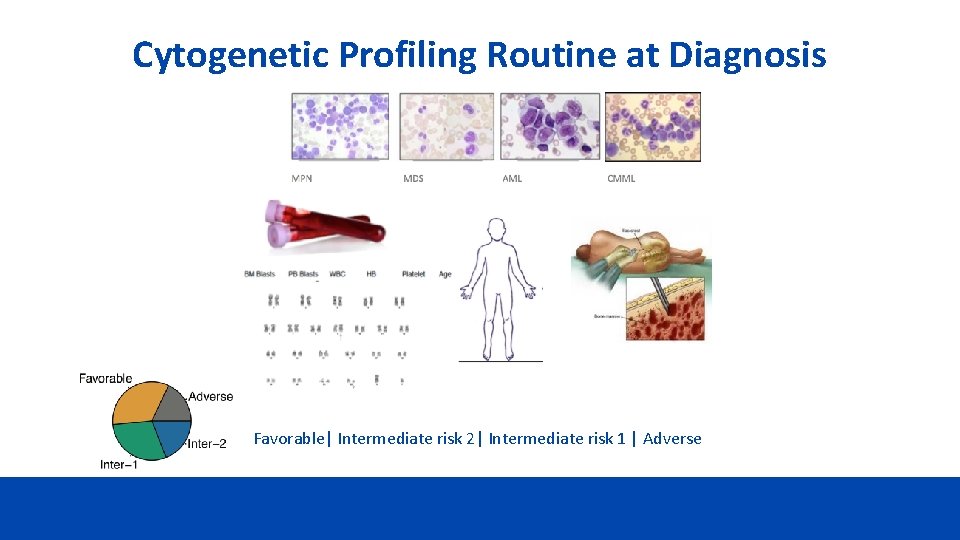 Cytogenetic Profiling Routine at Diagnosis Favorable| Intermediate risk 2| Intermediate risk 1 | Adverse