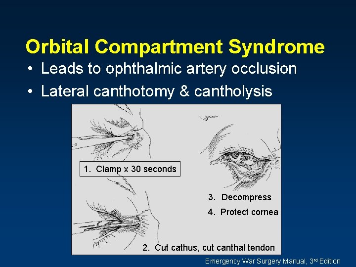 Orbital Compartment Syndrome • Leads to ophthalmic artery occlusion • Lateral canthotomy & cantholysis