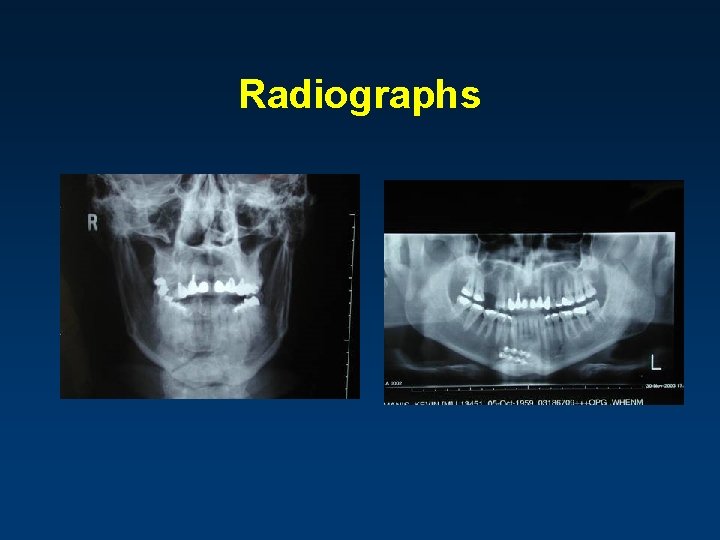 Radiographs 