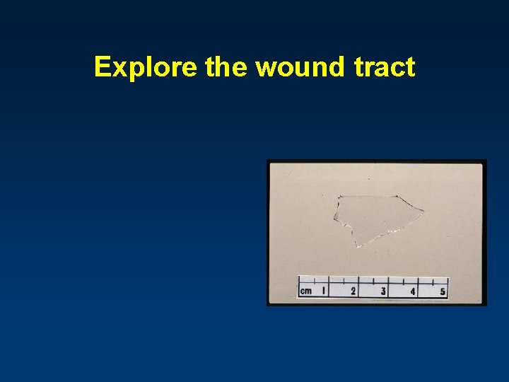 Explore the wound tract 