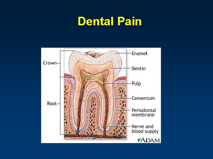 Dental Pain 