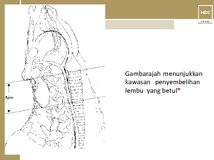 TM Gambarajah menunjukkan kawasan penyembelihan lembu yang betul* 