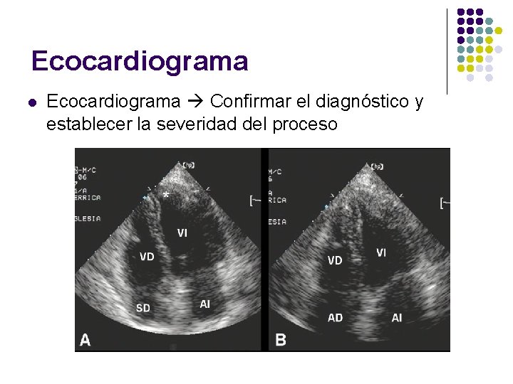 Ecocardiograma l Ecocardiograma Confirmar el diagnóstico y establecer la severidad del proceso 