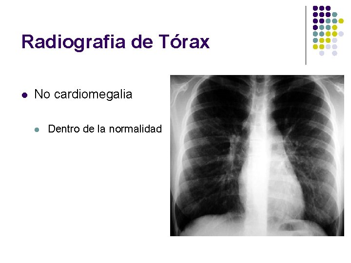 Radiografia de Tórax l No cardiomegalia l Dentro de la normalidad 