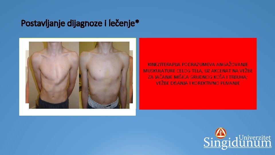 Postavljanje dijagnoze i lečenje* 1. Klinički pregled – da li je deformitet vidljiv, kakav