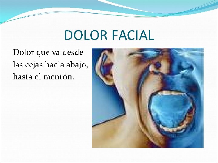 DOLOR FACIAL Dolor que va desde las cejas hacia abajo, hasta el mentón. 