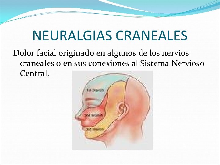 NEURALGIAS CRANEALES Dolor facial originado en algunos de los nervios craneales o en sus