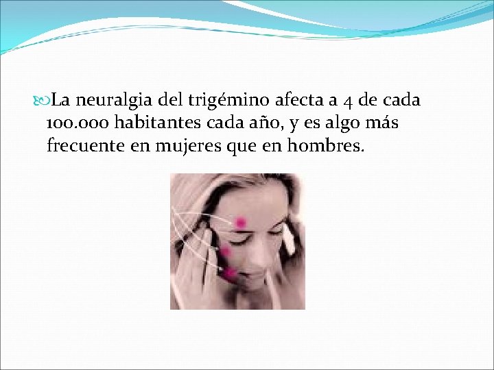  La neuralgia del trigémino afecta a 4 de cada 100. 000 habitantes cada