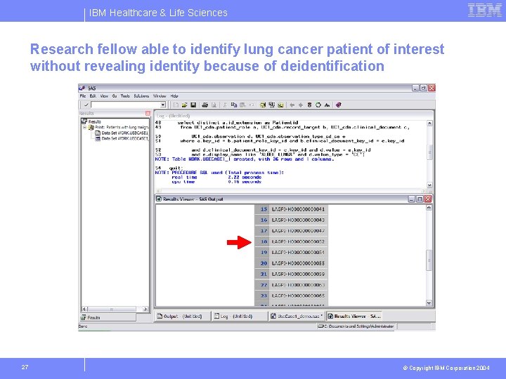 IBM Healthcare & Life Sciences Research fellow able to identify lung cancer patient of