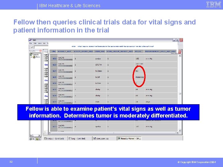 IBM Healthcare & Life Sciences Fellow then queries clinical trials data for vital signs