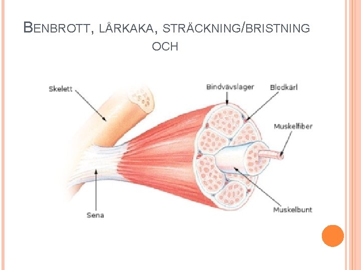 BENBROTT, LÅRKAKA, STRÄCKNING/BRISTNING OCH 