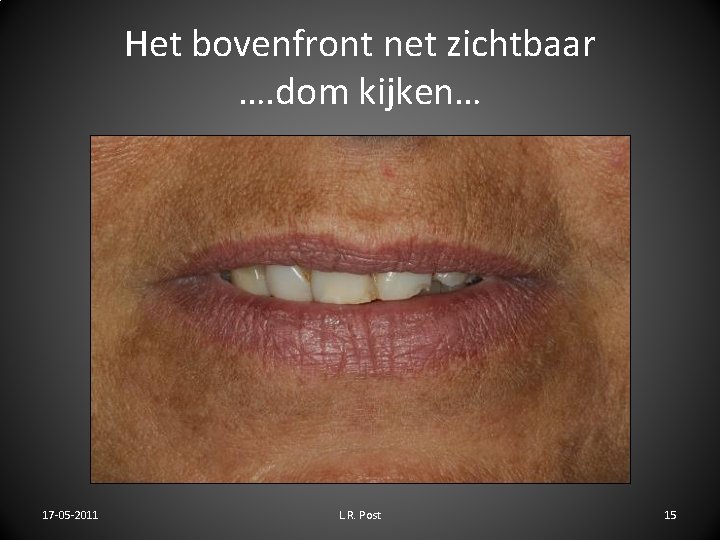 Het bovenfront net zichtbaar …. dom kijken… 17 -05 -2011 L. R. Post 15