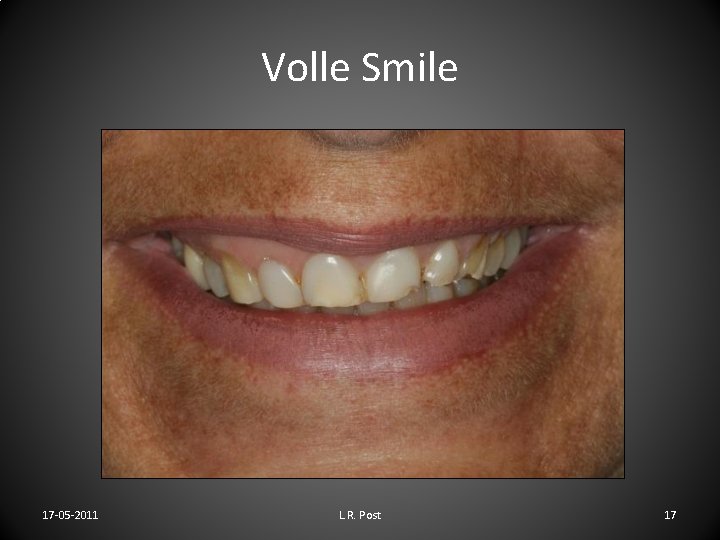 Volle Smile 17 -05 -2011 L. R. Post 17 