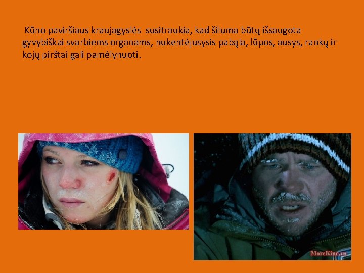  Kūno paviršiaus kraujagyslės susitraukia, kad šiluma būtų išsaugota gyvybiškai svarbiems organams, nukentėjusysis pabąla,