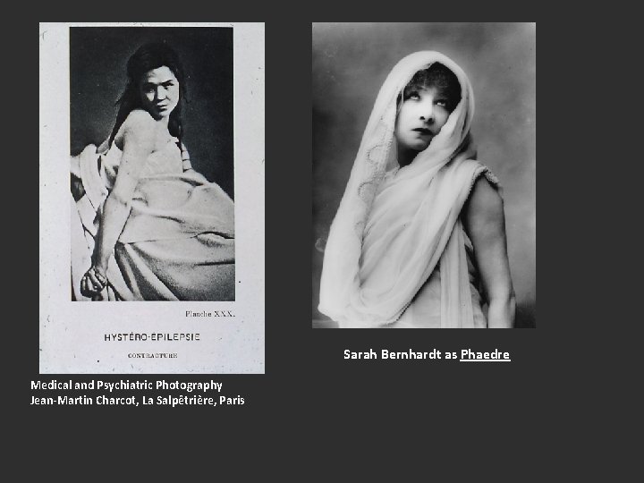 Sarah Bernhardt as Phaedre Medical and Psychiatric Photography Jean-Martin Charcot, La Salpêtrière, Paris 