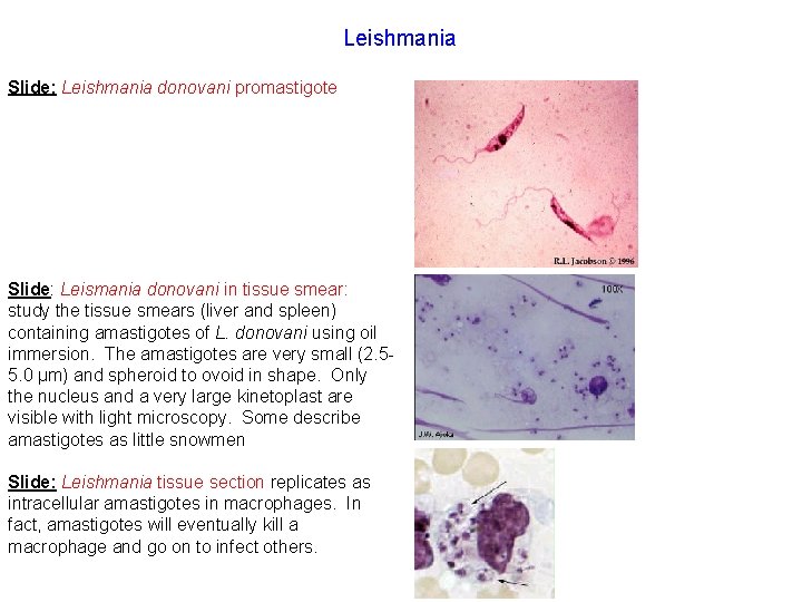 Leishmania Slide: Leishmania donovani promastigote Slide: Leismania donovani in tissue smear: study the tissue