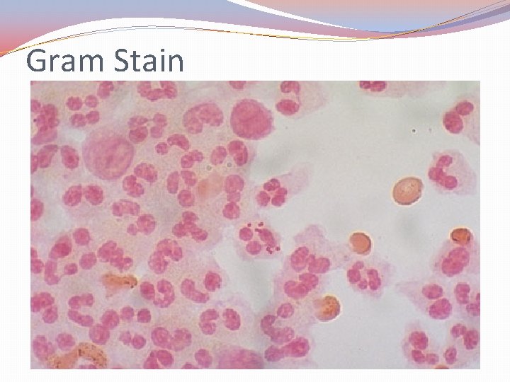 Gram Stain 