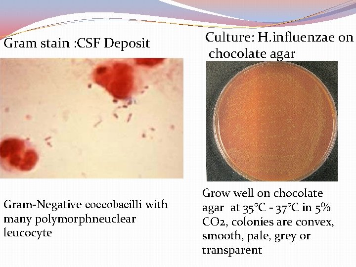 Gram stain : CSF Deposit Culture: H. influenzae on chocolate agar Gram-Negative coccobacilli with