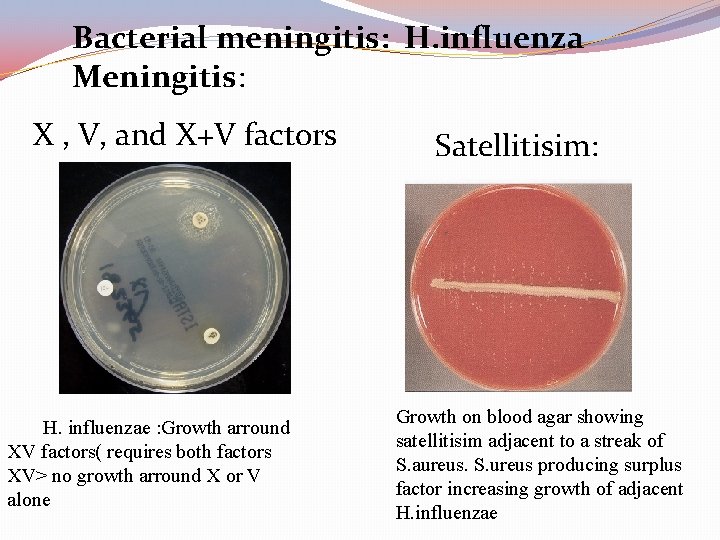 Bacterial meningitis: H. influenza Meningitis: X , V, and X+V factors H. influenzae :