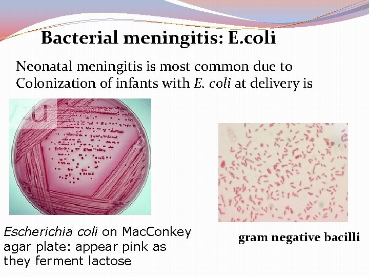 Bacterial meningitis: E. coli Neonatal meningitis is most common due to Colonization of infants