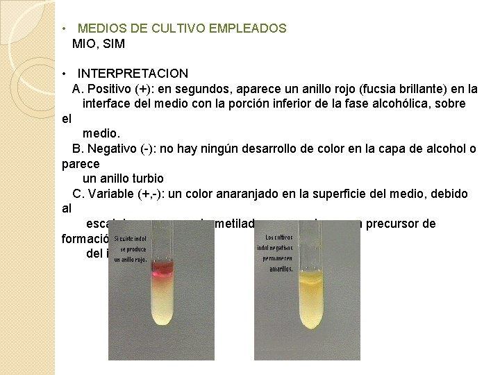  • MEDIOS DE CULTIVO EMPLEADOS MIO, SIM • INTERPRETACION A. Positivo (+): en