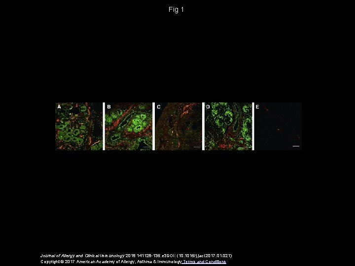 Fig 1 Journal of Allergy and Clinical Immunology 2018 141128 -136. e 3 DOI: